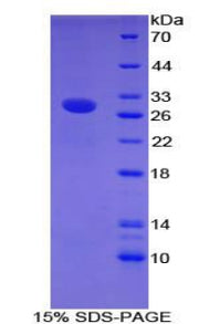 Figure 1. SDS-PAGE