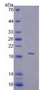 Figure 2. SDS-PAGE
