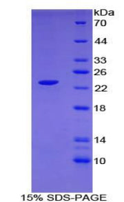 Figure 1. SDS-PAGE
