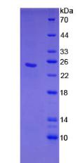Figure 2. SDS-PAGE