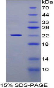 Figure 1. SDS-PAGE