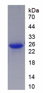 Figure 1. SDS-PAGE