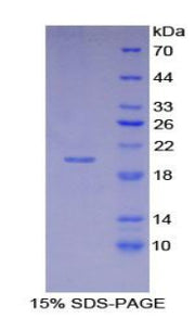 Figure 1. SDS-PAGE