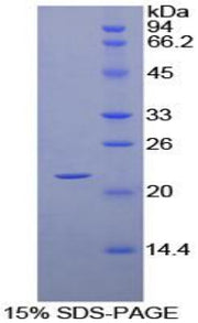 Figure 1. SDS-PAGE