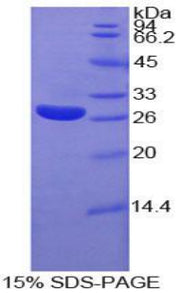 Figure 1. SDS-PAGE