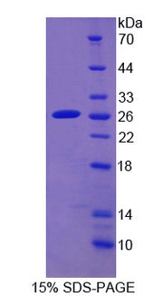 Figure 1. SDS-PAGE