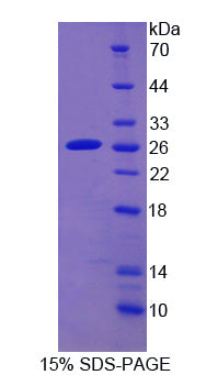Figure 1. SDS-PAGE