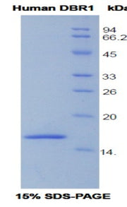 Figure 1. SDS-PAGE