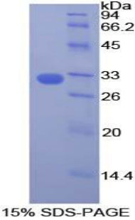 Figure 1. SDS-PAGE