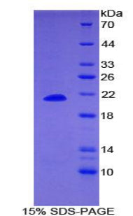 Figure 1. SDS-PAGE