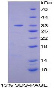 Figure 1. SDS-PAGE