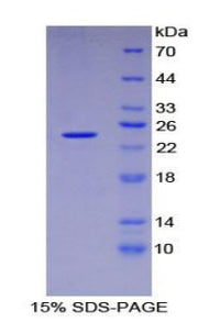 Figure 1. SDS-PAGE