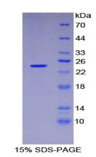 Figure 1. SDS-PAGE