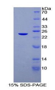 Figure 1. SDS-PAGE