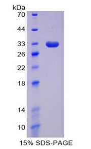 Figure 1. SDS-PAGE