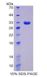 Figure 1. SDS-PAGE