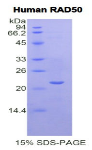 Figure 1. SDS-PAGE