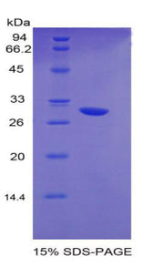 Figure 1. SDS-PAGE