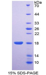 Figure 1. SDS-PAGE