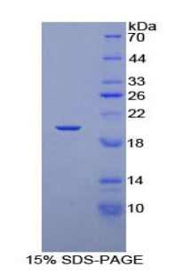 Figure 1. SDS-PAGE