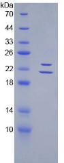 Figure 3. SDS-PAGE