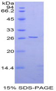 Figure 1. SDS-PAGE
