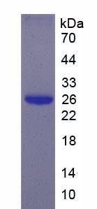 Figure 2. SDS-PAGE