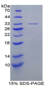 Figure 1. SDS-PAGE