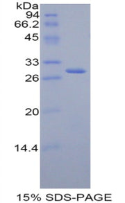 Figure 1. SDS-PAGE