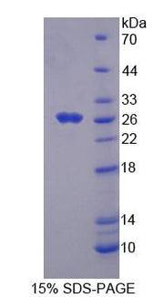 Figure 1. SDS-PAGE