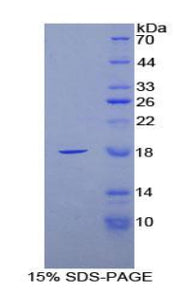 Figure 1. SDS-PAGE