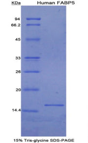Figure 1. SDS-PAGE