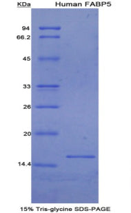 Figure 1. SDS-PAGE