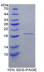 Figure 1. SDS-PAGE