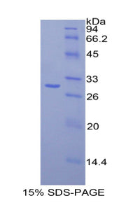 Figure 1. SDS-PAGE