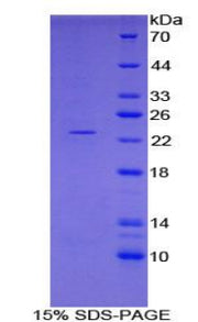 Figure 1. SDS-PAGE