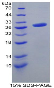 Figure 1. SDS-PAGE