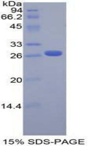 Figure 1. SDS-PAGE