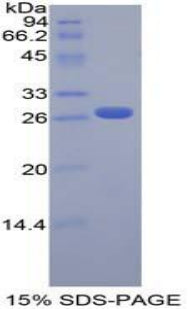 Figure 1. SDS-PAGE