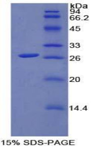 Figure 1. SDS-PAGE