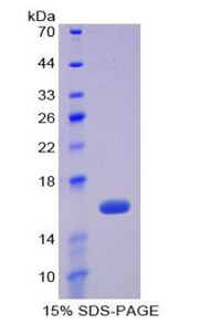 Figure 1. SDS-PAGE