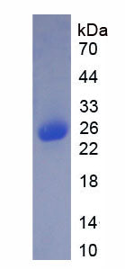 Figure 1. SDS-PAGE