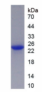 Figure 1. SDS-PAGE