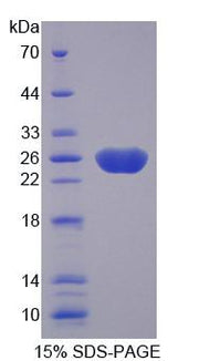 Figure 1. SDS-PAGE