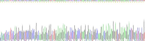 Recombinant Human Ficolin 1 (FCN1)