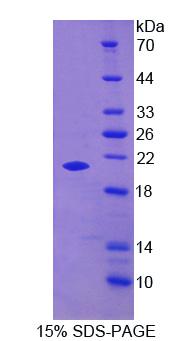 Figure 1. SDS-PAGE