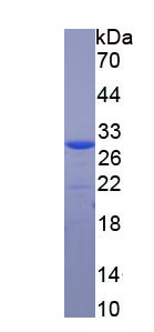 Figure 1. SDS-PAGE