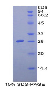 Figure 1. SDS-PAGE