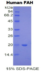 Figure 1. SDS-PAGE