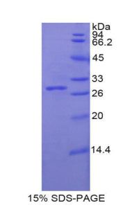 Figure 1. SDS-PAGE